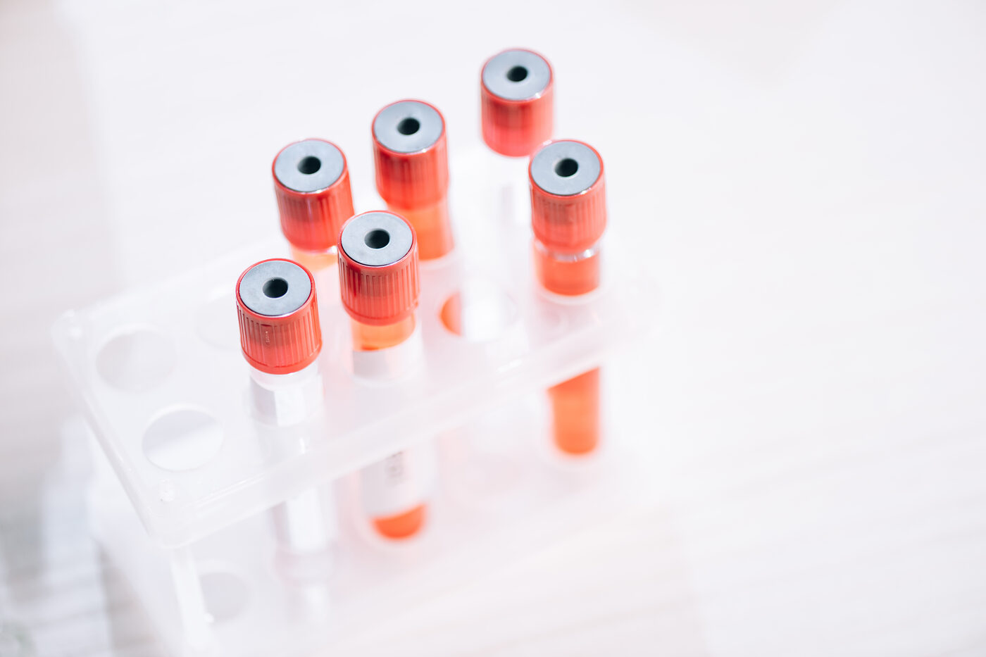 Lipoprotein(a) im Blut