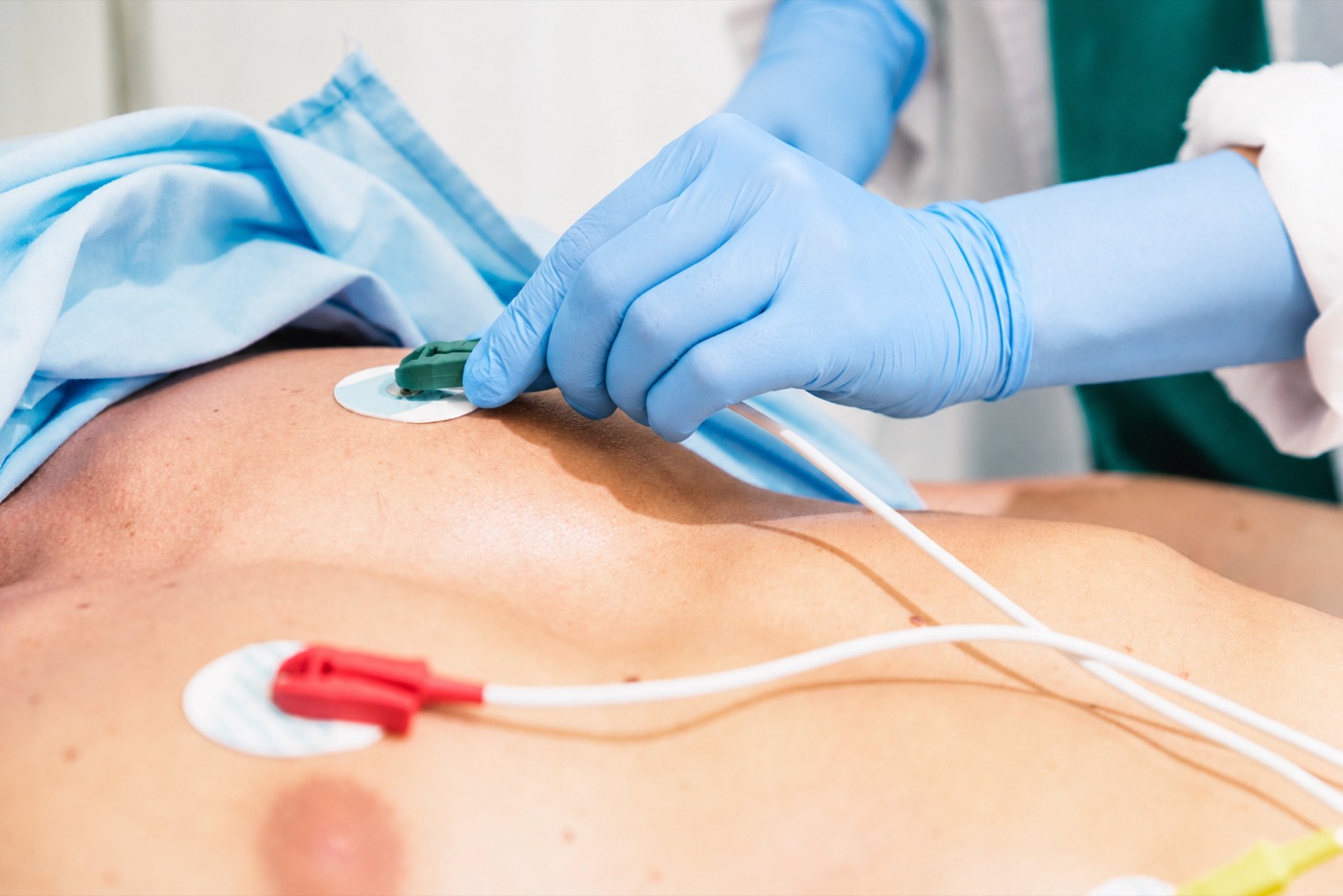 EKG